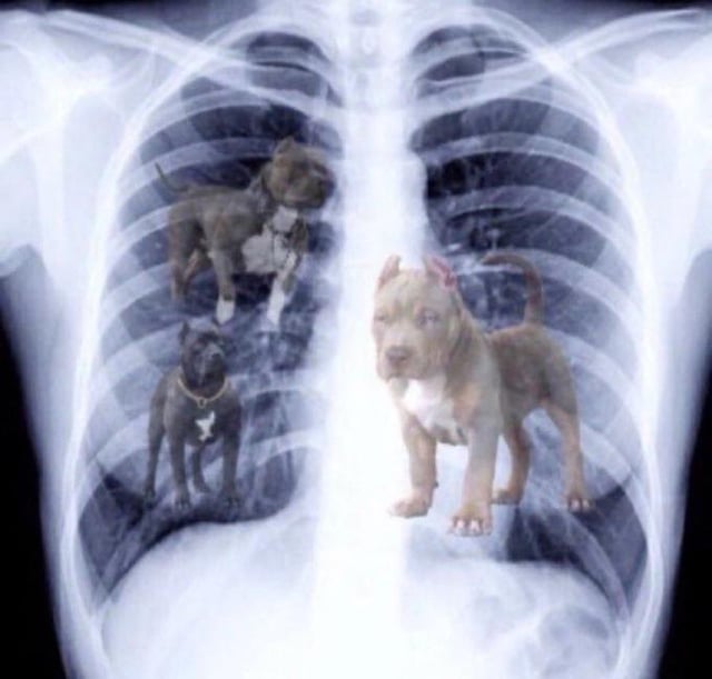 JDM and Belal post fight X-ray revealed.