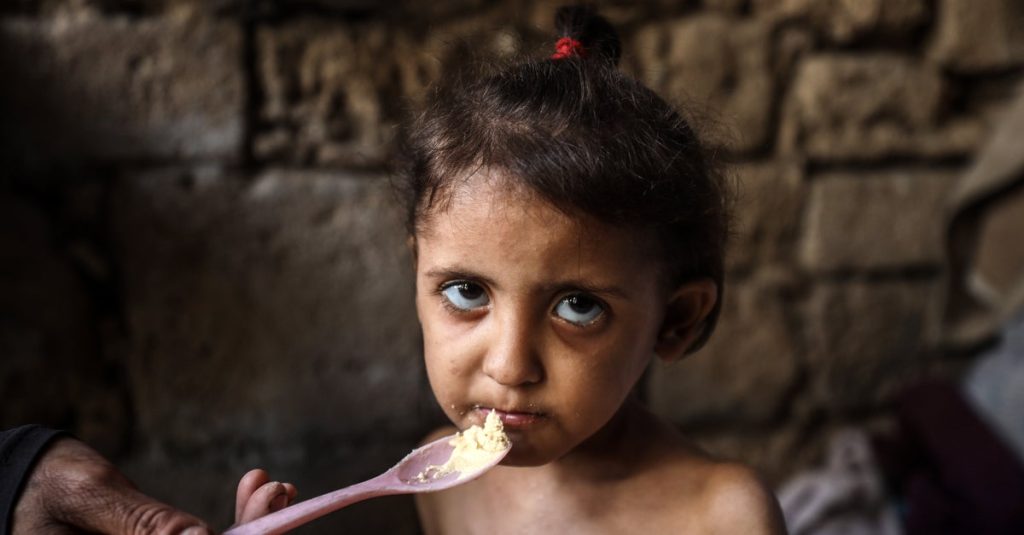 ‘Let The Children Eat’: Israel Is Starving Gaza To Death, Doctors And Experts Warn