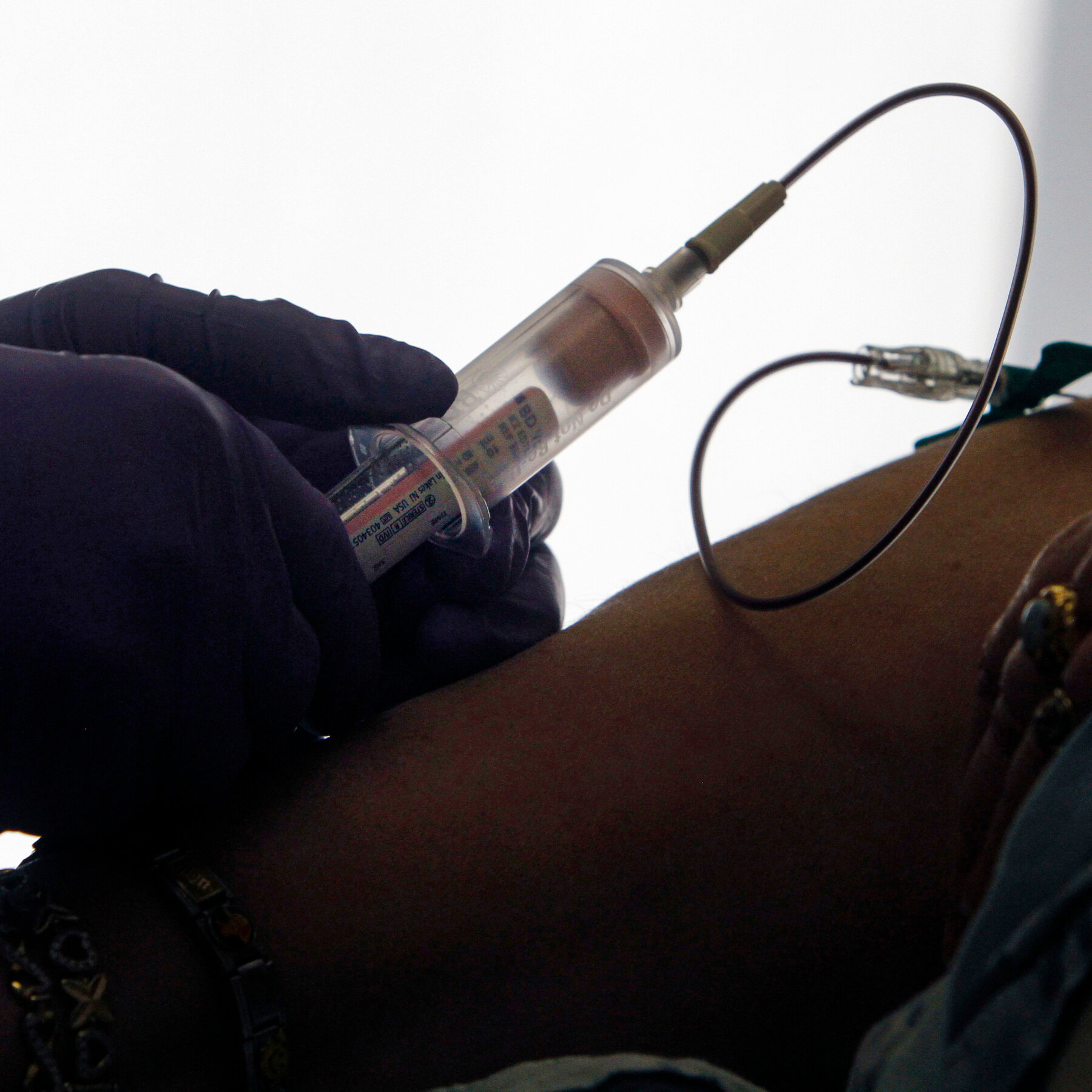Breast Cancer Patients Get Early Warning of Faltering Drugs With Blood Test